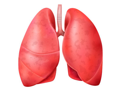 Nadciśnienie płucne