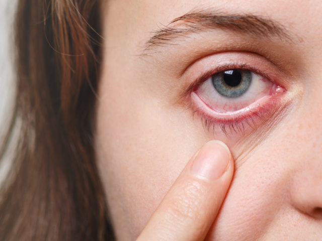 Nadciśnienie oczne – przyczyny, objawy, leczenie