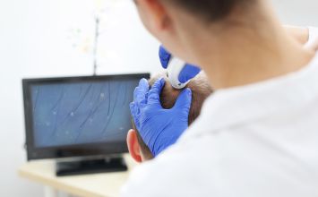 Nadmierne wypadanie włosów: choroby, które powodują utratę włosów