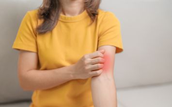 Zapalenie tkanki łącznej (cellulitis): czym się objawia, jakie przebiega leczenie?