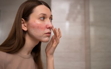 Gronkowiec: zakażenie, objawy i antybiotyk na zakażenie gronkowcem