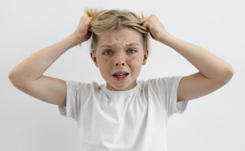 Łysienie plackowate u dzieci: objawy, przyczyny i leczenie