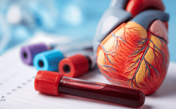 Hipercholesterolemia – co to jest? Przyczyny, objawy i leczenie