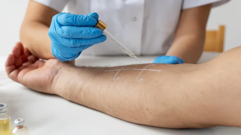 Lekarz alergolog - Jak mogę Ci pomóc?